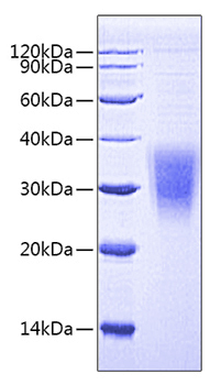 Recombinant human nkg2-a/nkg2-b typ e ii integral membrane protein protein 50 µg