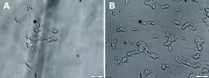 Brain-derived neurotrophic factor human 10 µg
