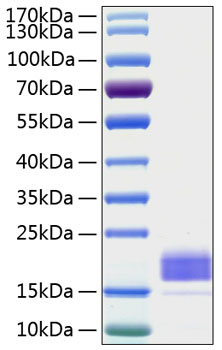 Recombinant human tigit protein 20 µg