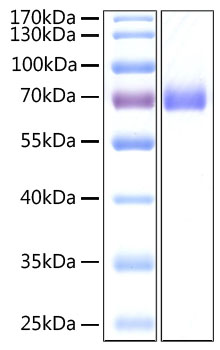 Recombinant sars-cov-2 spike s2 ecd protein with his tag (s2 protein,spike glycoprotein subunit2,s g 100 µg