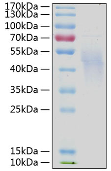 Recombinant human il4r/cd124 protei n (cd124,il-4ra,il4ra) p24394 20 µg