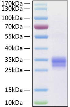 Recombinant human trance/rank l/tnf sf11 protein 50 µg