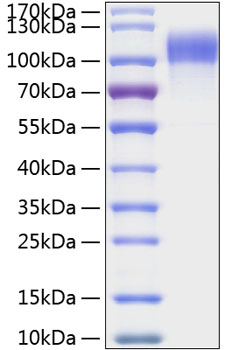 Recombinant human egfr protein 100 µg