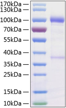 Recombinant human gfra1/gfri 1/gdnf ra protein 20 µg