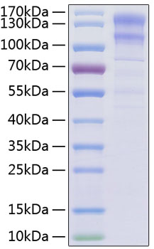 Recombinant human ldlr/ldl recepto r protein 10 µg