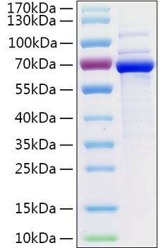 Recombinant human 5 -nucleotidase/c d73 protein 20 µg