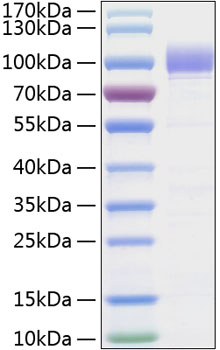 Recombinant human siglec-9/cd329 pr otein (siglec-9,siglec9,cdw329,cd329,foap-9) q9y336 50 µg