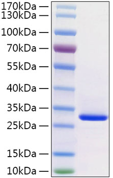 Recombinant human vsig8 protein ((v ide)) q5vu13 500 µg