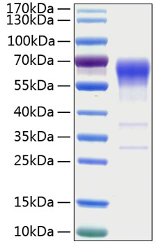 Recombinant human acvr2b/activin ri ib protein 10 µg