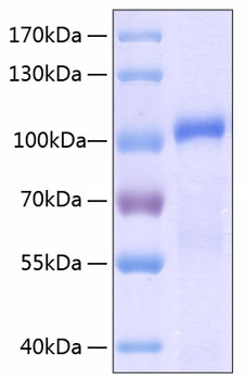Recombinant human mmp-9/clg4b prote in 50 µg