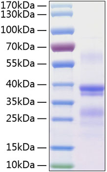 Recombinant human rgma protein 50 µg