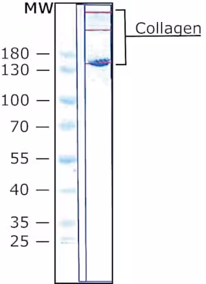 Collagen from from chicken sternal cart 5 mg