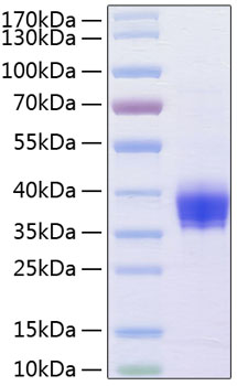 Recombinant human epcam/trop-1 protein 100 µg