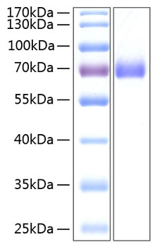 Recombinant human epha2 protein (ar cc2,ctpa,ctpp1,ctrct6,eck) p29317 50 µg