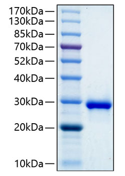 Recombinant human igfbp-1 protein 50 µg