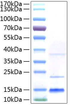 Recombinant human cd72 protein (cd7 2b, lyb2) p21854 1000 µg