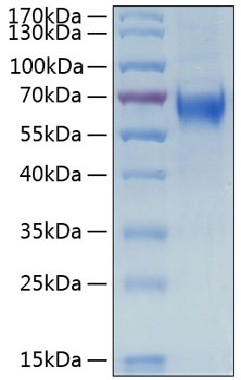 Recombinant human il-6 r alpha protein 100 µg