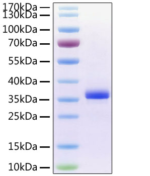Recombinant human noggin protein 50 µg