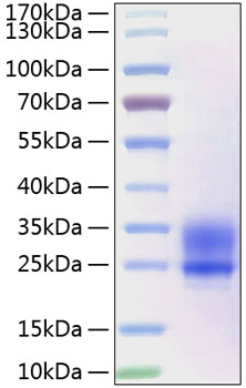 Recombinant human frizzled-5 protei n 10 µg