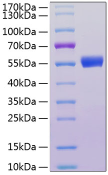 Recombinant human il-18racp protein 50 µg
