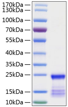 Recombinant human gtpase kras/kras protein 20 µg