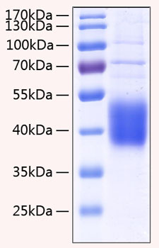 Recombinant human il-21r/interleuki n-21 receptor protein 50 µg