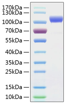Recombinant human her2/erbb2 protei n 50 µg