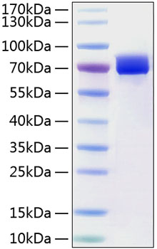 Recombinant human mesothelin protei n 20 µg