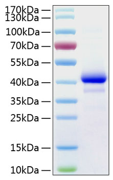Recombinant human igf1 protein 50 µg
