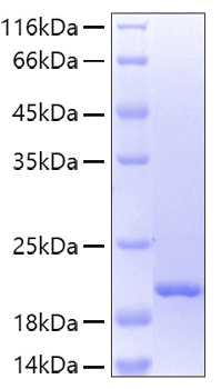 Recombinant human lcn2/ngal protein 20 µg