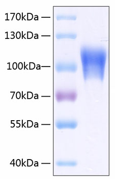 Recombinant human cd146/mcam protei n 500 µg