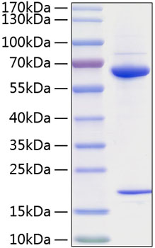 Recombinant human pcsk9 protein 50 µg