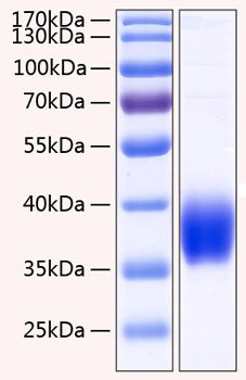 Recombinant human carbonic anhydras e xii/ca12 protein 20 µg