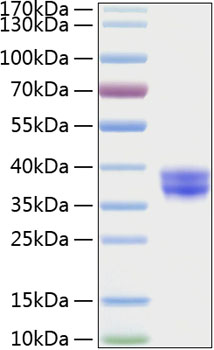 Recombinant human gpa33/glycoprotei n-a33 protein 20 µg