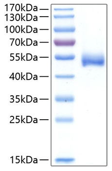 Recombinant human chit1 protein 100 µg