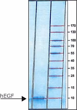 Epidermal growth factor human egf 5 x 0,2 mg
