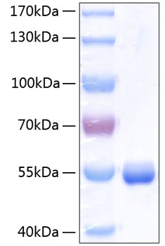 Recombinant human rbp4 protein (rdc cas) p02753 100 µg