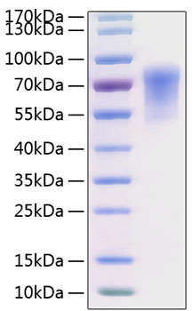 Recombinant human cadm1/igsf4a prot ein 10 µg