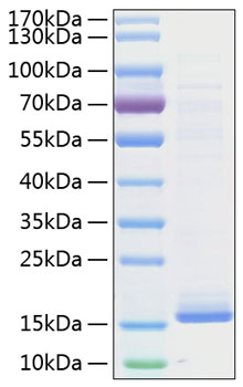 Recombinant human cystatin d protei n 50 µg