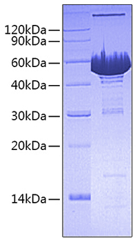 Recombinant human pre-b-cell colony -enhancing factor 1/pbef/visfatin protein 10 µg
