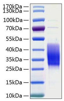 Recombinant human tim-3 protein 100 µg