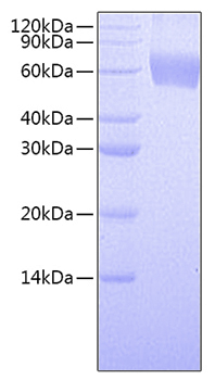 Recombinant human gm-csf r alpha/cs f2ra protein 10 µg
