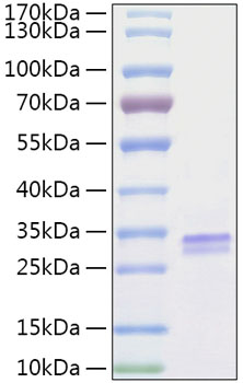 Recombinant human vsig2 protein (22 10413p10rik, cth, ctxl) q96iq7 500 µg