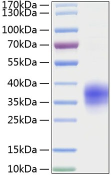 Recombinant mouse tnfr1/cd120a/tnfr sf1a protein 20 µg
