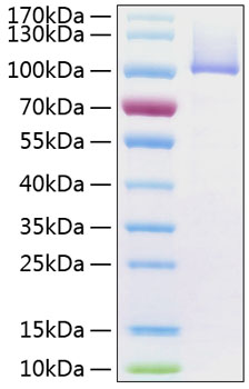 Recombinant human fap protein (dppi v,dppiva,fapa,fibroblast activation protein alpha,simp) q12884 50 µg