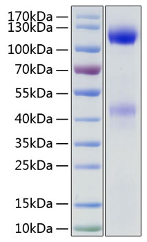 Recombinant human insulin receptor protein 50 µg