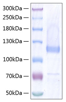 Recombinant human comp protein 500 µg
