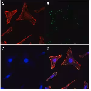 Actin/focal adhesion stain kit-ea 1 EA