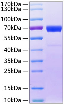 Recombinant human il-20rb protein 50 µg