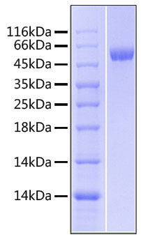Recombinant human lbp/lipopolysacch aride-binding protein protein 1000 µg